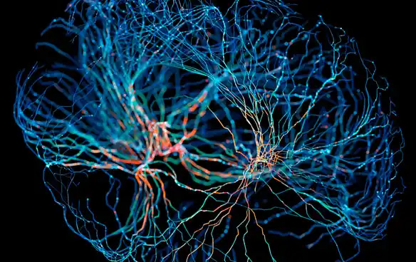 Cerebro Alzheimer AFA Guardo