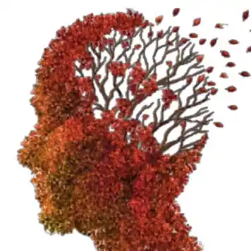 Cuerpos de lewy, demencias en AFA Guardo